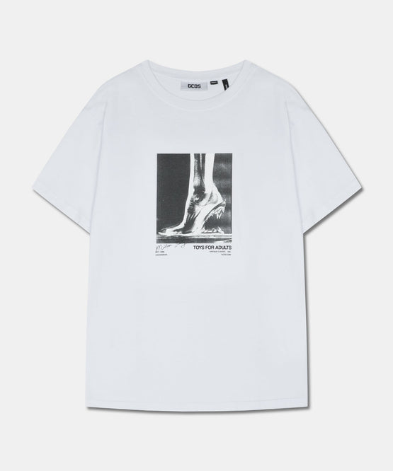 MORSO OVERSIZE T-SHIRT